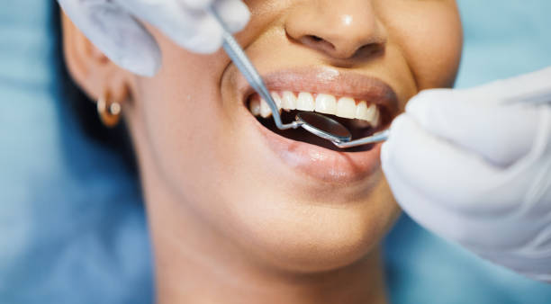 Best Tooth Pain Emergency Relief  in Putney, GA